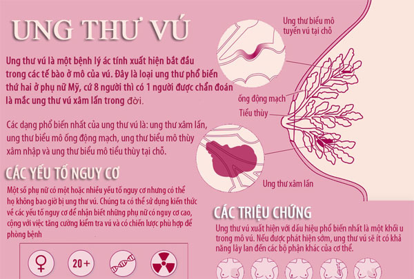 Trieu Chung Va Cach Phat Hien Ung Thu Vu 0